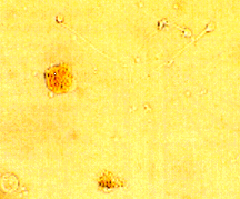 leucocells.png
