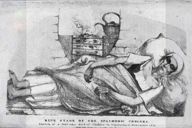 1831年10月一位死于霍乱的女孩.jpg