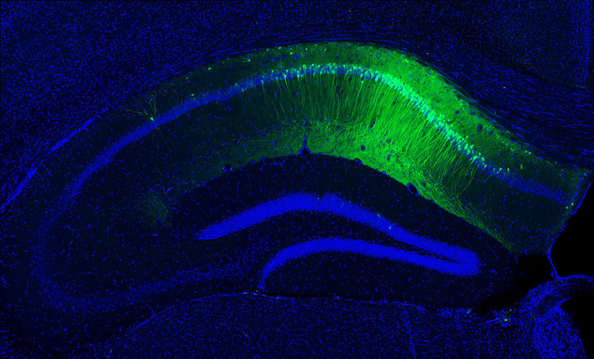 Hippocampal-CA1_byDheeraj-RoyTonegawa-Lab-MIT.jpg