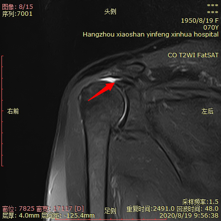 1614649013319044.png 微信图片_20210302093633.png