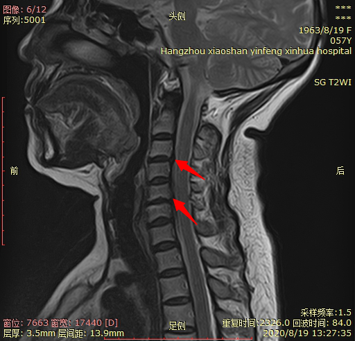 1614649039413917.png 微信图片_20210302093707.png