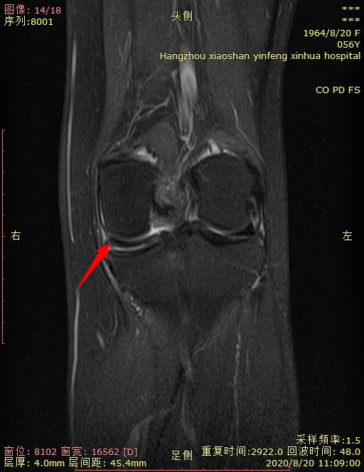 1614649111372364.png 微信图片_20210302093818.png