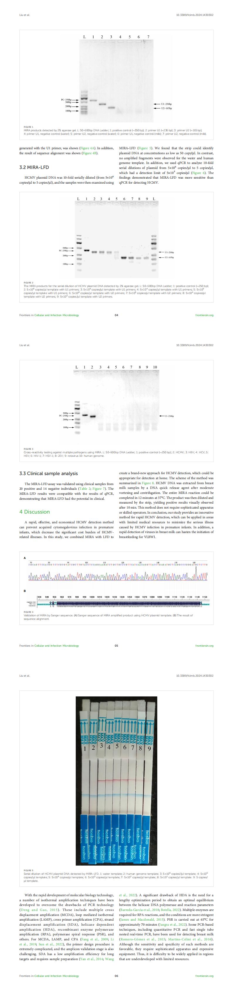 53.Rapid detection of human cytomegalovirus by multienzyme isothermal rapid amplification and lateral flow dipsticks_00(1).jpg