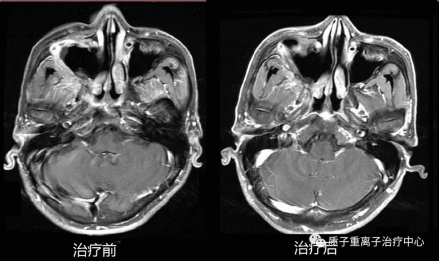 image.gif