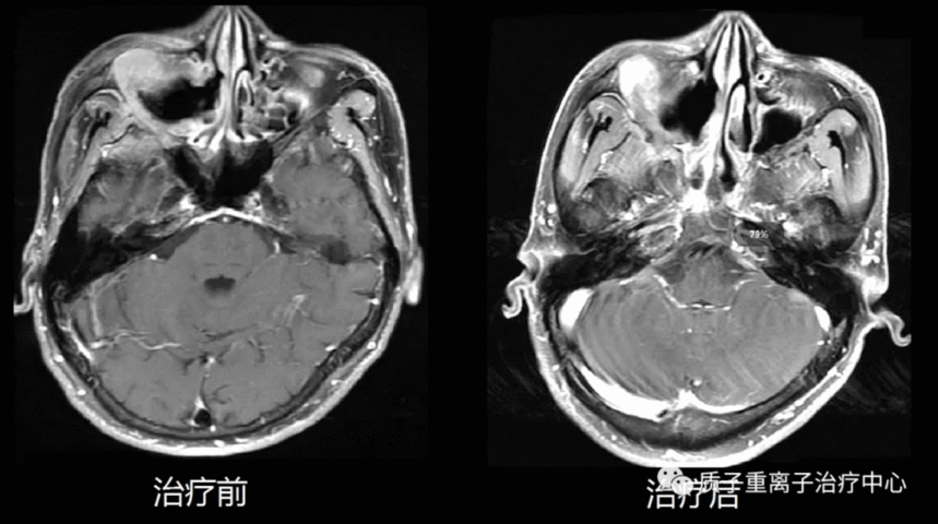 image.gif
