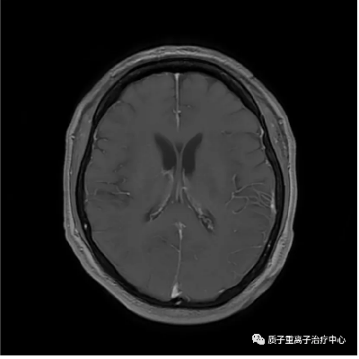 image.gif