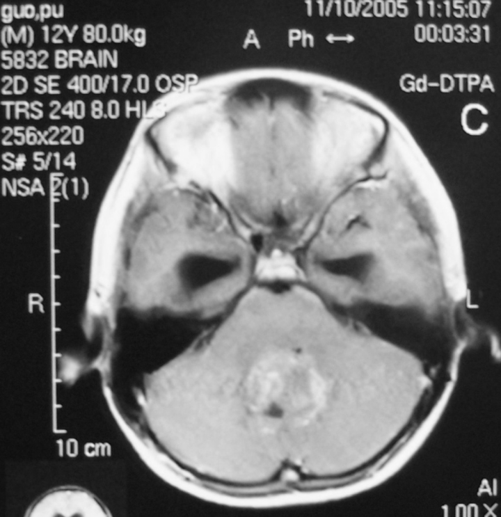 image.gif