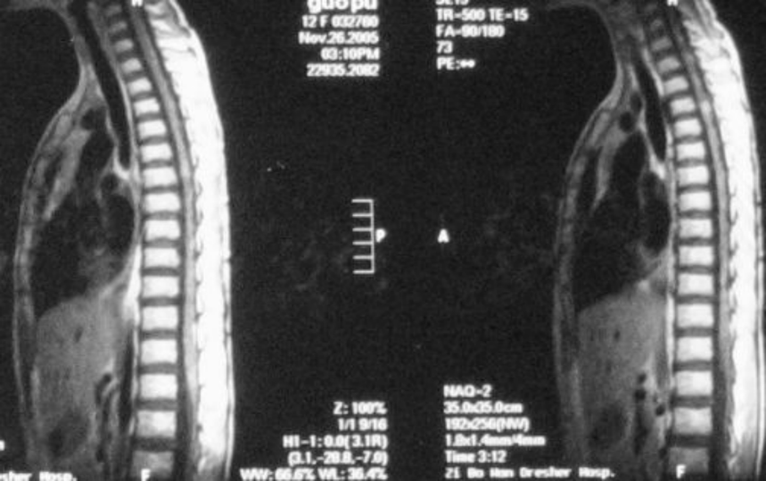 image.gif