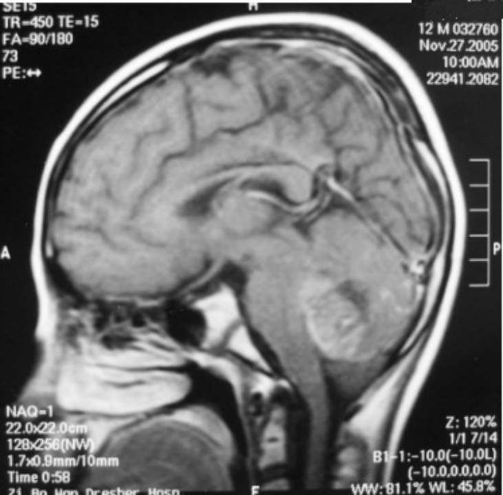 image.gif
