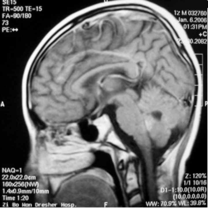 image.gif