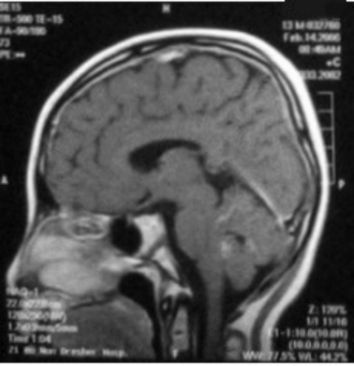 image.gif