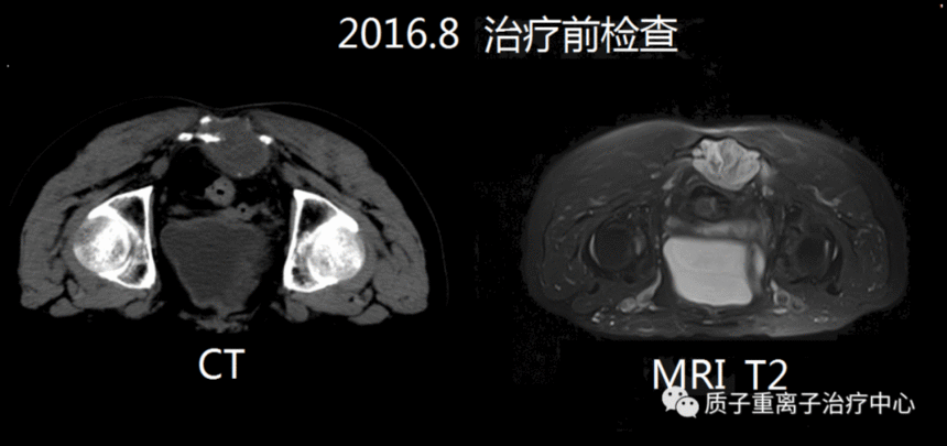 image.gif