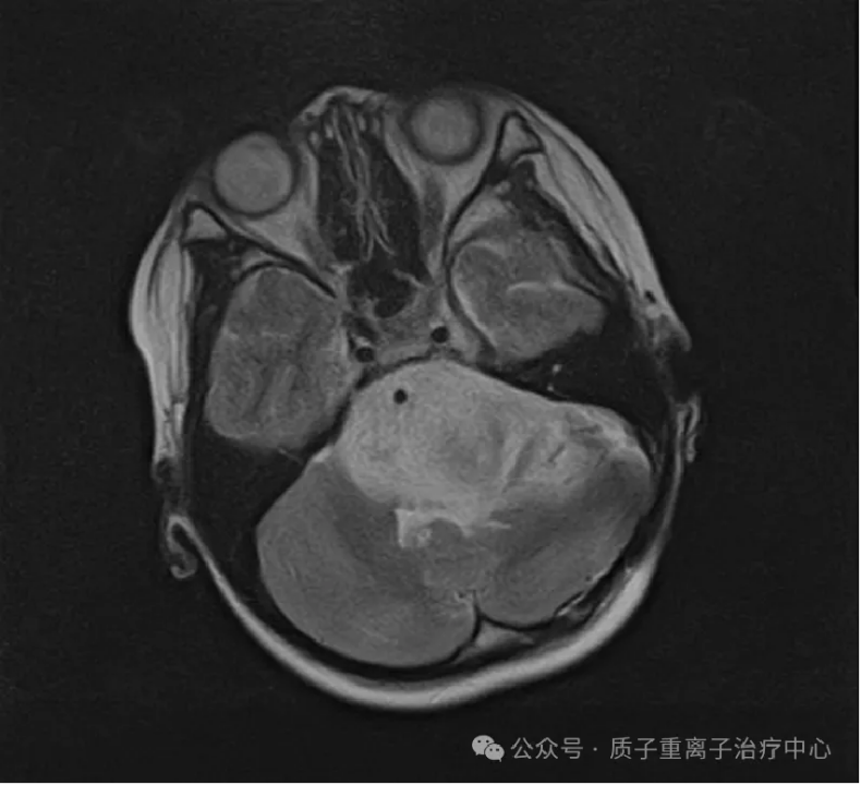 image.gif