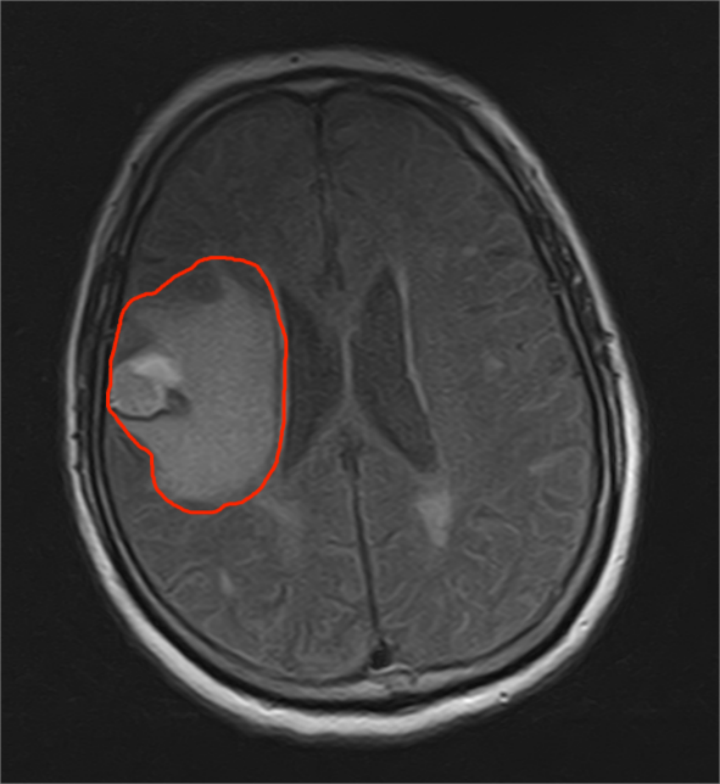 image.gif