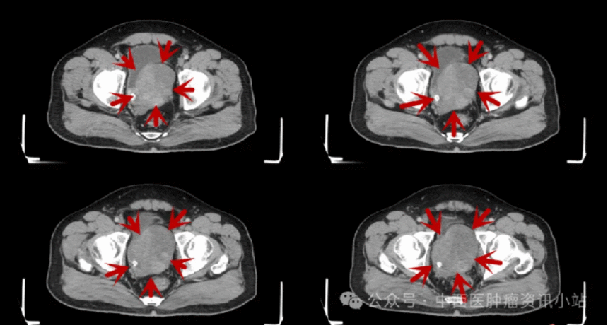 image.gif