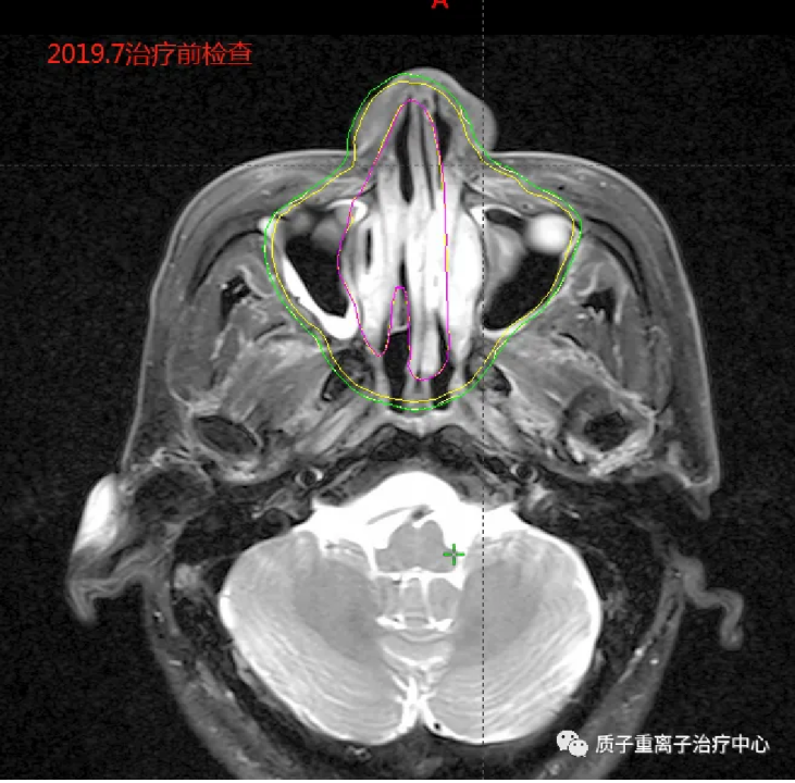 image.gif