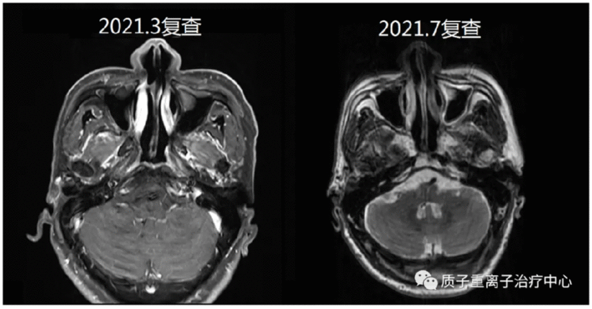 image.gif