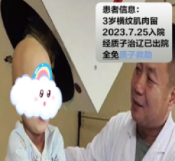 横纹肌肉瘤