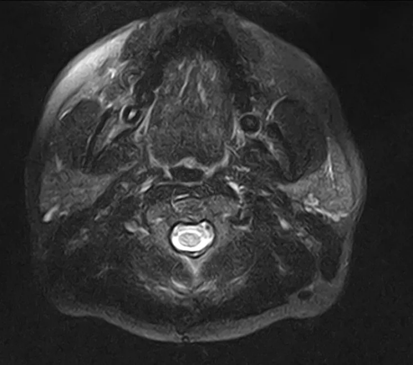 image.gif