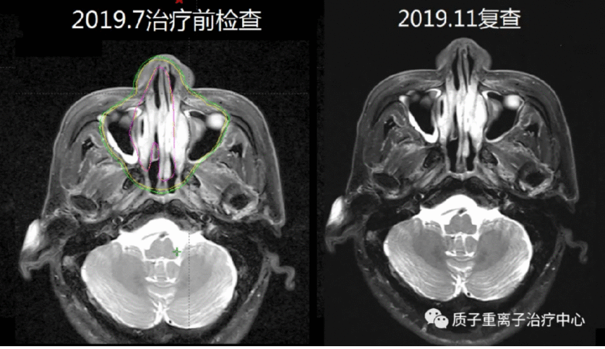 image.gif
