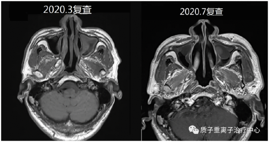 image.gif