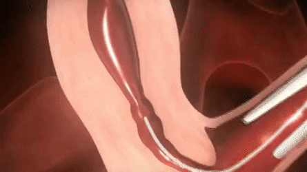 0 (3).gif