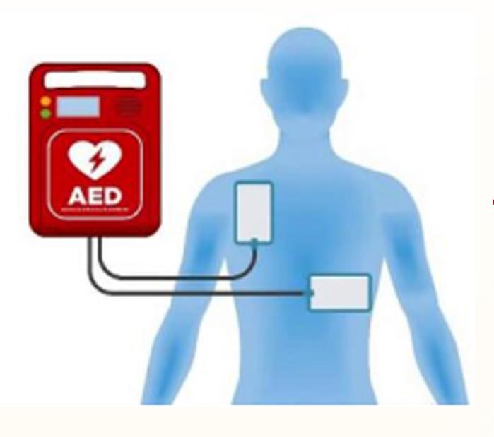 AED除顫心肺復蘇