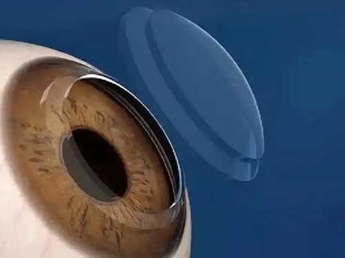 1767771460699866.jpg ½ÇĤËÜÐξµ£¨6.9£©.webp.jpg