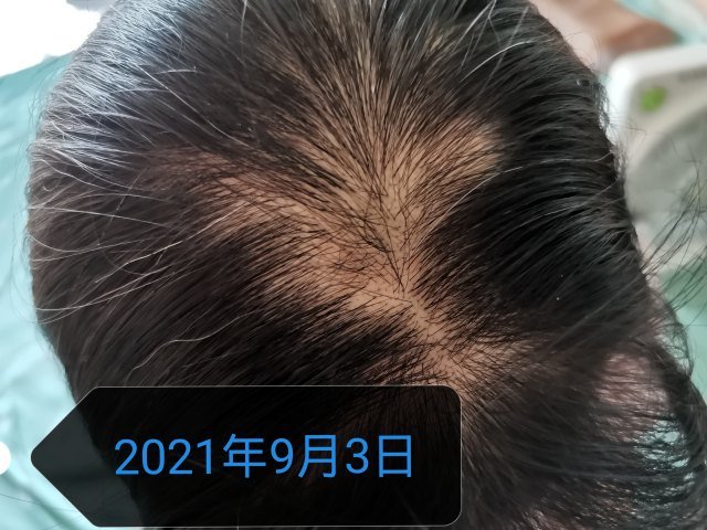 1635169717295664.jpg