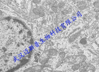 神經(jīng)組織超微結(jié)構(gòu)觀(guān)察