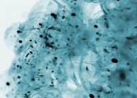 植物組織透射電鏡取材實(shí)驗(yàn)注意事項(xiàng)