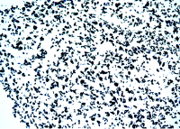 植物切片盧戈氏染色實(shí)驗(yàn)步驟