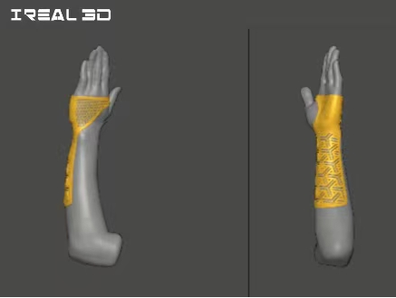 iReal 3DҽӦ-Ϊǿƻṩƻ