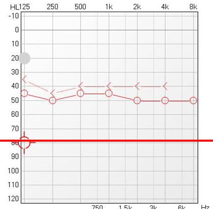 src=http_%2F%2Fwww.medlive.cn%2Fuploadfile%2F20170307%2F14888572562354.png&refer=http_%2F%2Fwww.medlive.jpg