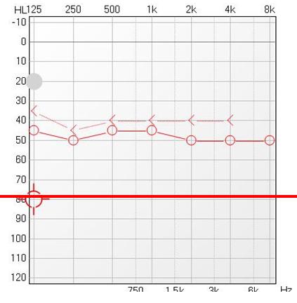 src=http_%2F%2Fwww.medlive.cn%2Fuploadfile%2F20170307%2F14888572562354.png&refer=http_%2F%2Fwww.medlive.jpg