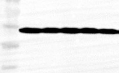1670566391194398.png 条带粘连.png
