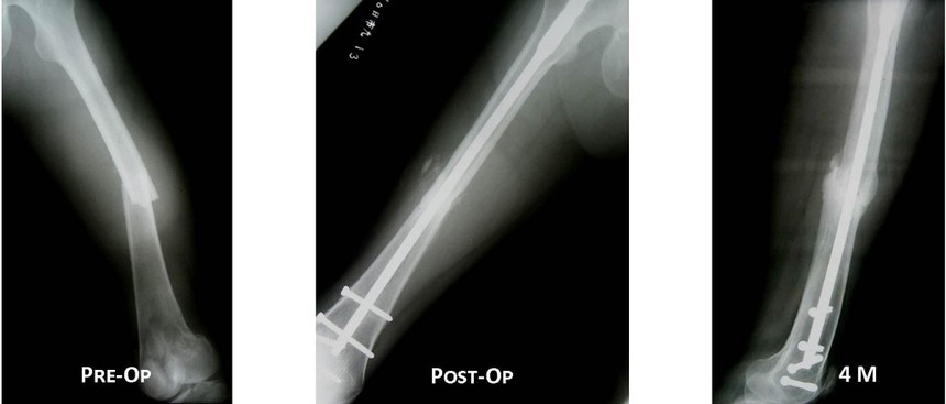Case5-1024x437.jpeg