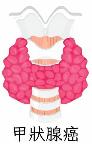 1720084953887853.png image.png