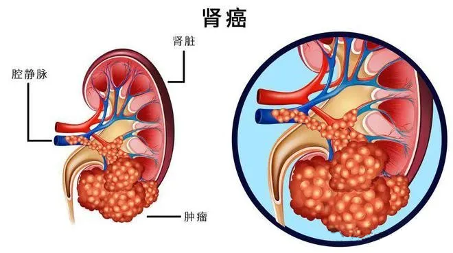 1720085233454717.png image.png