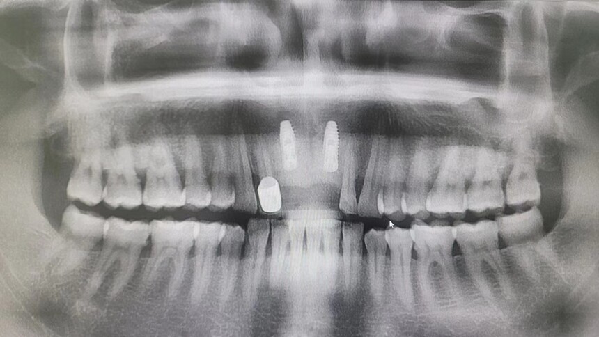 1701151671903056.jpg