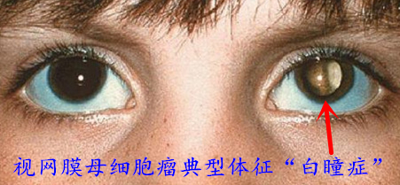 ʧ1.png