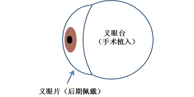 ҽ2.png