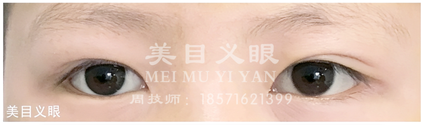 ͯ03.png
