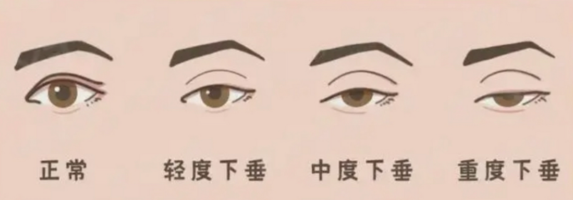 ´01.png