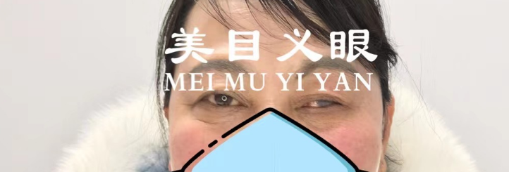 ì1.png