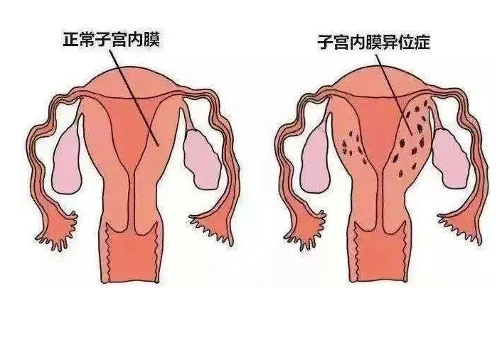 Թ