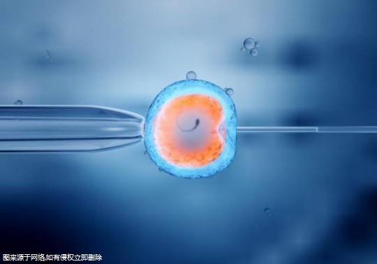 rC8f4NuaJ7wQ0P24Ys7T.jpg