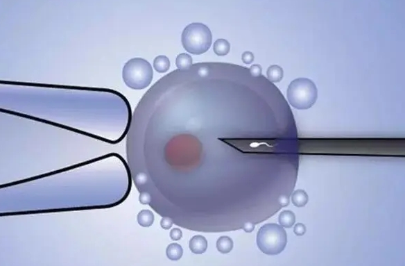 myzx260013721317890002.png