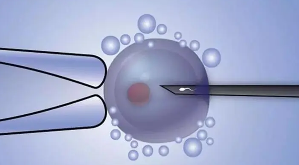 myzx480014001040187002.png