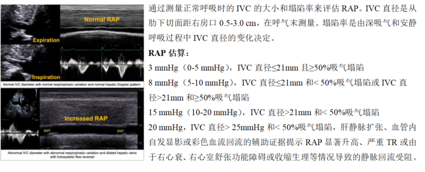 924e2daee53f078bc802831cb01721bb.png